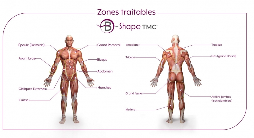 les zones traitables du B-Shape TMC